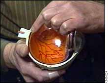 Eyeball